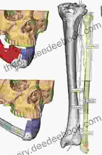 Atlas Of Mandibular And Maxillary Reconstruction With The Fibula Flap: A Step By Step Approach