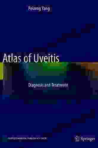 Atlas Of Uveitis: Diagnosis And Treatment