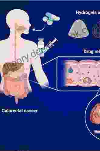 Recent Advances In The Treatment Of Colorectal Cancer